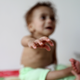A malnourished boy cries in his home in Sanaa June 20, 2012. (Reuters /Mohamed al-Sayaghi